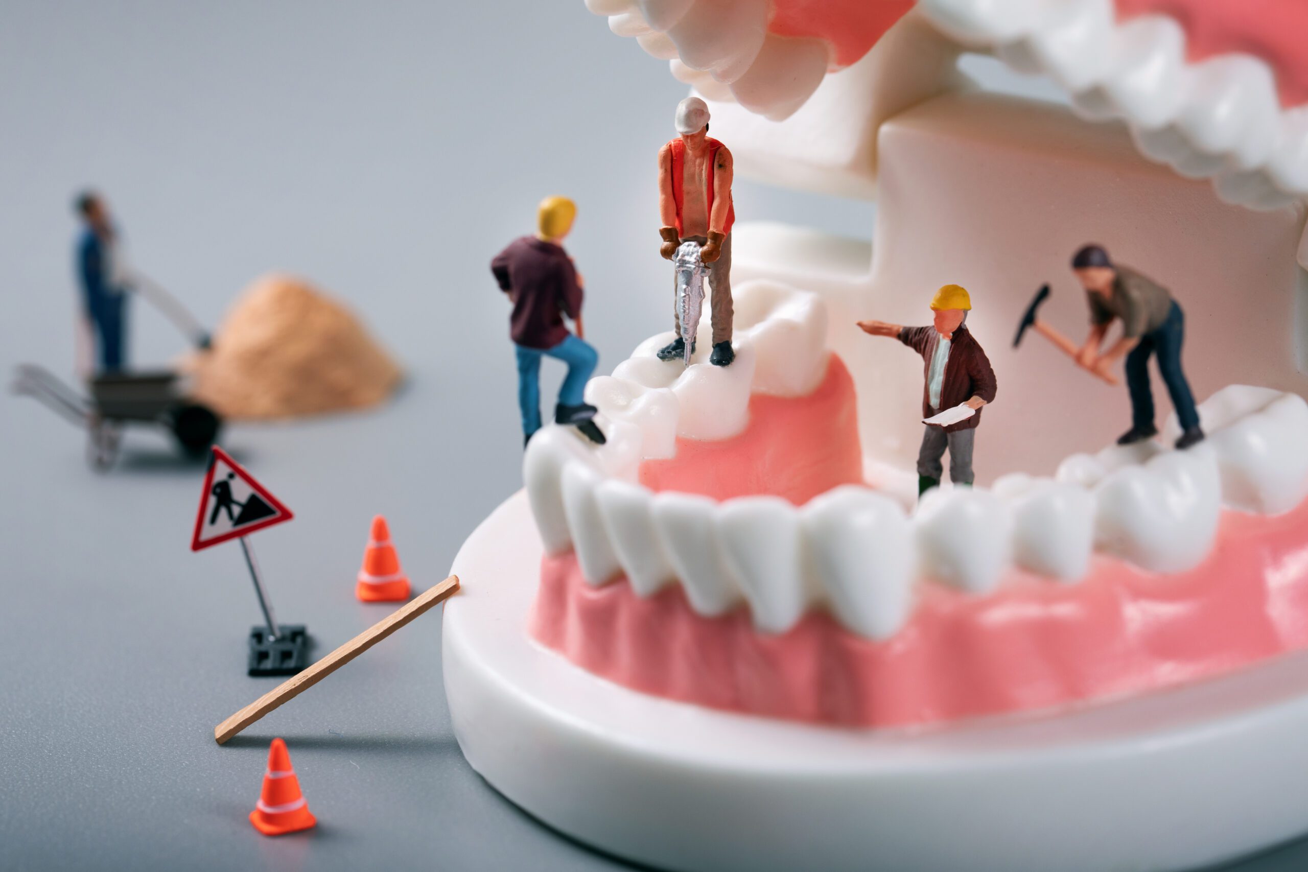 dental treatment concept - construction workers figurines on too